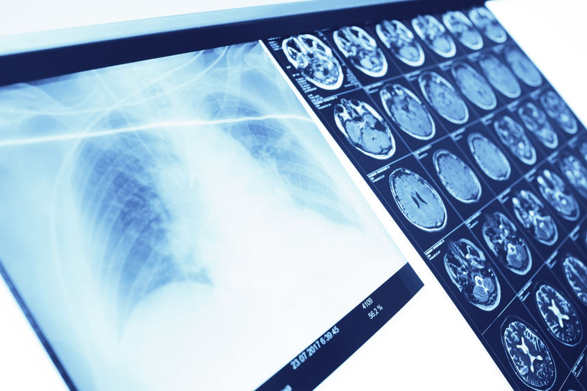 imaging results